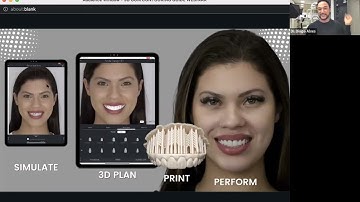 SmileFy Webinar | 3D Gum Contouring Guide - Learn the 3D Design Workflow with SmileFy