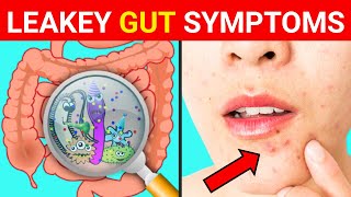 Leaky Gut : 10 Signs and Symptoms of Leaky Gut Syndrome | ( Gut Health ) || Leaky Gut Symptoms