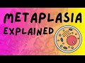 What is Metaplasia? Types and Examples (Pathology Help) Pathology Lecture