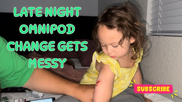 OMNIPOD POMPWISSEL LAAT! #T1D