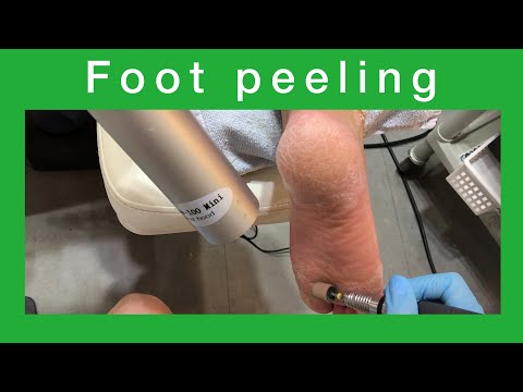 foot peeling Korea Beauty Salon Gangnam Refuss 발관리 발각질제거