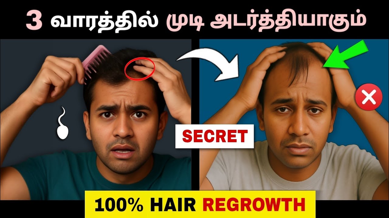 Full Guide to Stop Hair Loss & Regrow Hair NATURALLY (3 Easy Step) 🤯 ...