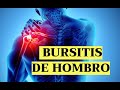 BURSITIS DE HOMBRO