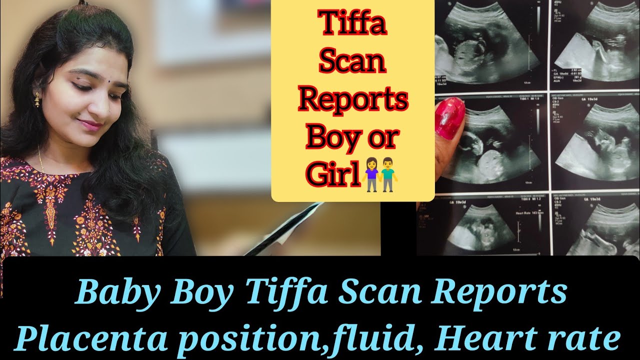 Baby boy tiffa scan reports in telugu Placenta position Gender prediction Baby ultrasound