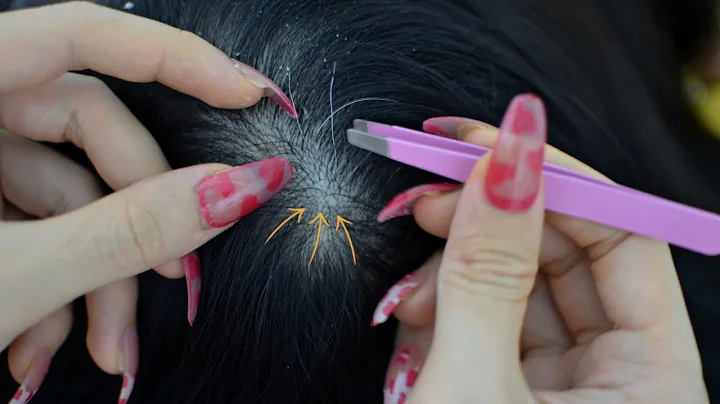 ASMR Scalp Check, Scalp Picking With Tweezers For Relaxation ( No Talking