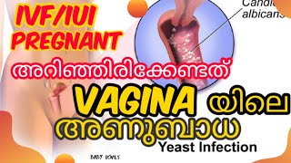Vaginal Infection Treatment& Care||IVF/IUI||Symptoms Of Yeast Infection||Baby Loves