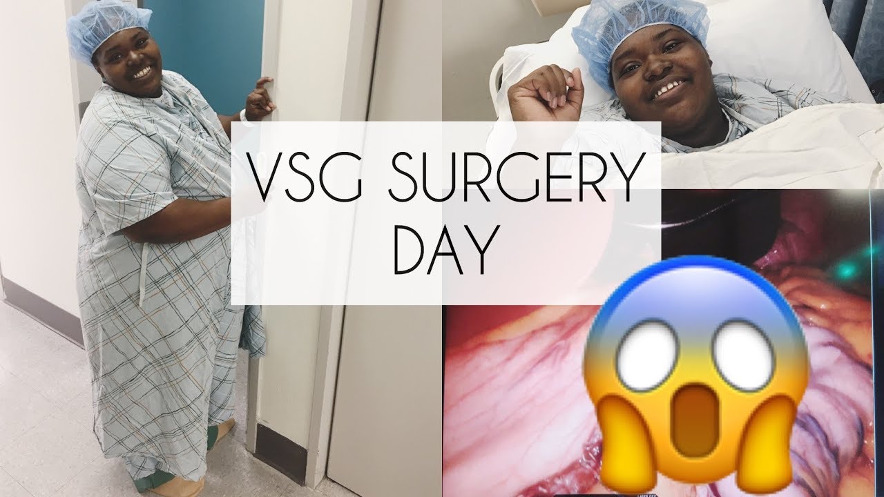 VSG SURGERY DAY WEIGHT LOSS SURGERY + DAY 1 & 2 PostOp UPDATE! YouTube