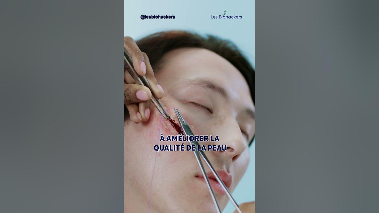 La thérapie à la lumière rouge : Révélez les bienfaits de cette technique révolutionnaire !