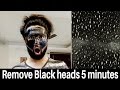 How to remove blackheads in 5 minutes | Peel off mask