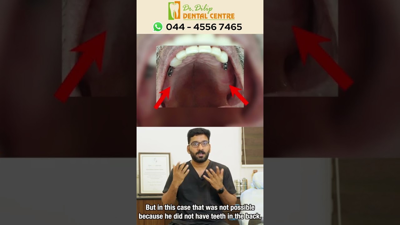 Part 2 | Hybrid Dentures!! | Alternatives to Dentures and Implants?