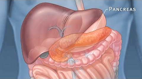 Pancreatic Auto Islet Transplantation with Total Pancreatectomy