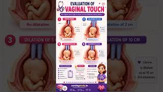 ✅ Cervical Dilation 0 to 10 cm Explained Simply | Labour & Delivery Guide 2026! #ytshorts