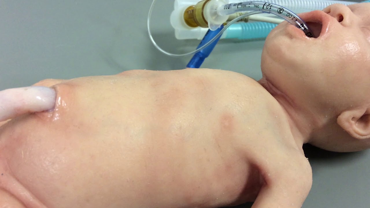 190717 Video 1   Normal Ventilation with Lifecast Premature baby 29 weeks