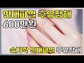 손가락 후유장해 보험금 600만 원! (풀영상)