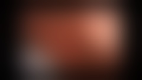 SIngle port VATS LUL lobectomy 2015 ATEP Choi