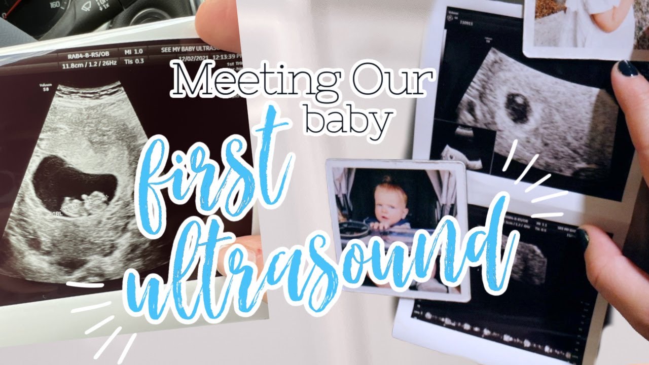 Our First Ultrasound After Two Miscarriages How Many Babies