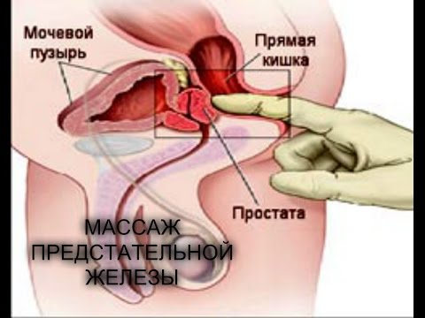 Как себе сделать массаж простаты видео самому себе