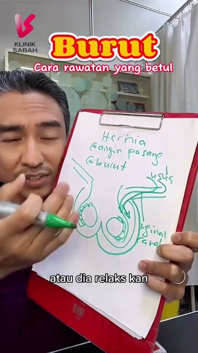 Cara rawatan hernia / angin pasang / burut yg betul. #anginpasang #hernia