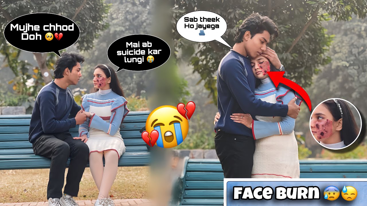 Face Burn Prank On Suhaan💔| He Started Crying 😭| Prank Gone Totally Emotional