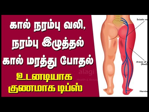 நரம்பு சுண்டி இழுத்தல் , கால் மரத்துப் போதல், கால் நரம்பு வலி / Home remedy for sciatica nerve pain