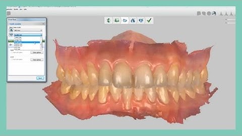 How to create the virtual base in Ortho Analyzer