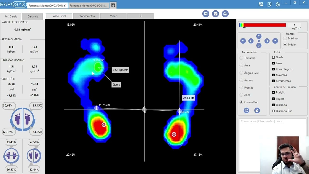 Aula Baropodometria por Daniel Camargo