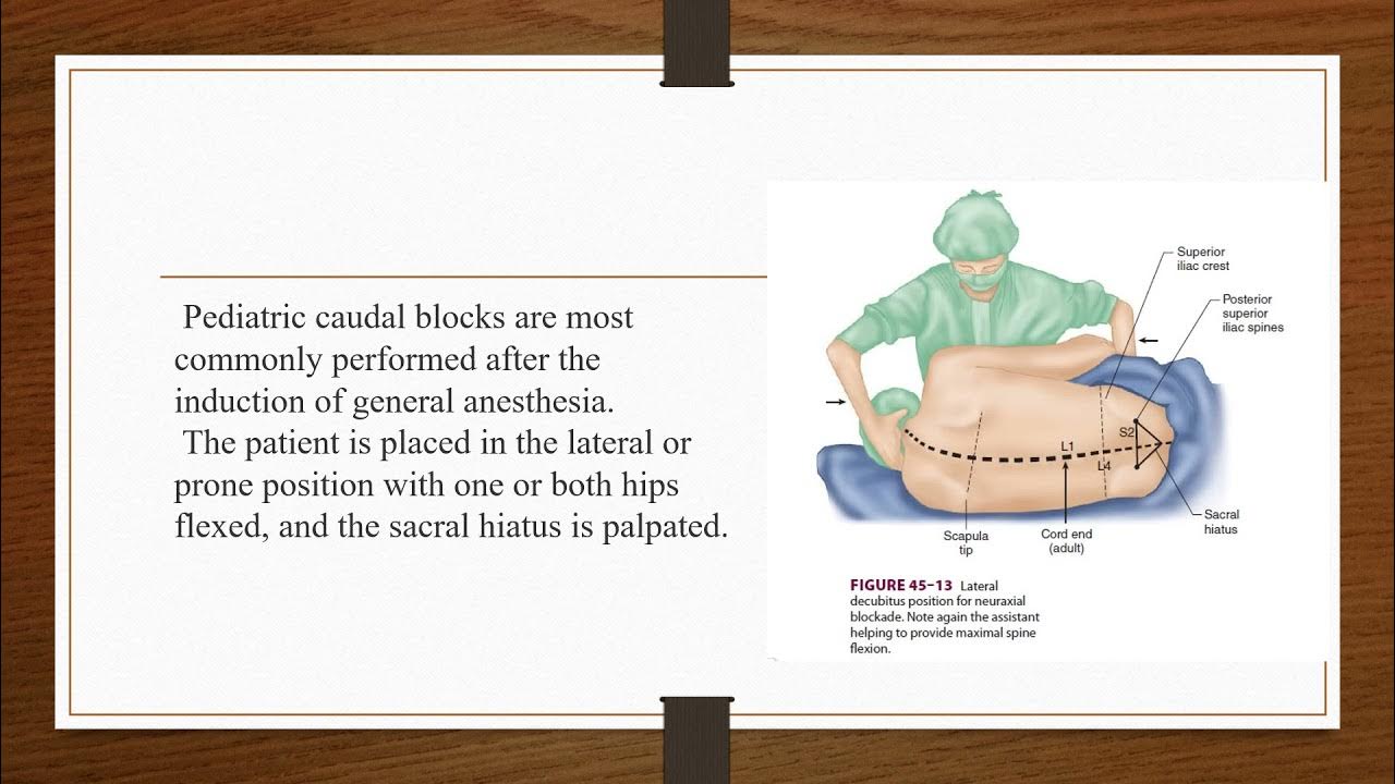 caudal anesthesia YouTube