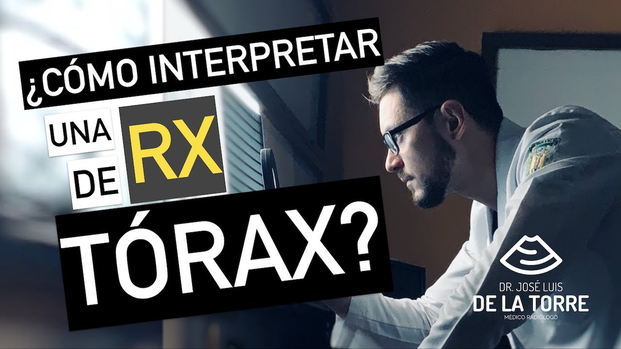 ¿Cómo interpretar una radiografía de tórax?