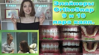 Элайнеры OrthoSnap 9 и 10 пара капп.  Ключ(Делюсь опытом исправления прикуса зубов с помощью элайнеров Orthosnap (Ортоснэп). Лечение прохожу в стоматолог..., 2016-08-24T15:42:40.000Z)