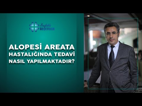 Video: Psixogen Alopesi Yanlış Diaqnoz Olduğunda