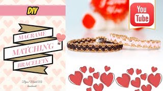 Hello everyone. today i want to show you how make these easy macrame
matching bracelets for couples. one bracelet will need: - 2 waxed
polyester c...
