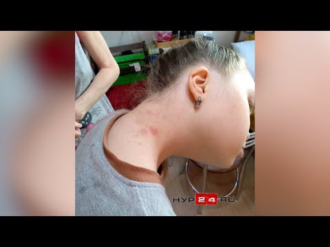 В Новом Уренгое в коррекционной школе ребенку причинили травмы