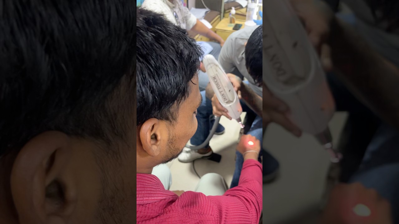 Tattoo removal ❤️🔥 