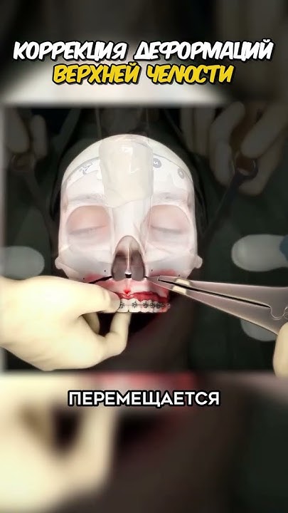 #медицина #познавательно #анимация - YouTube