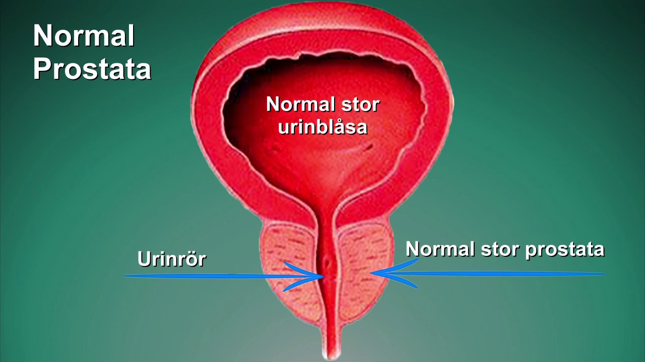 prostata urinrör prostata urinrör