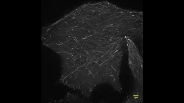 Demonstration of Olympus SD-OSR Super-Resolution Microscopy