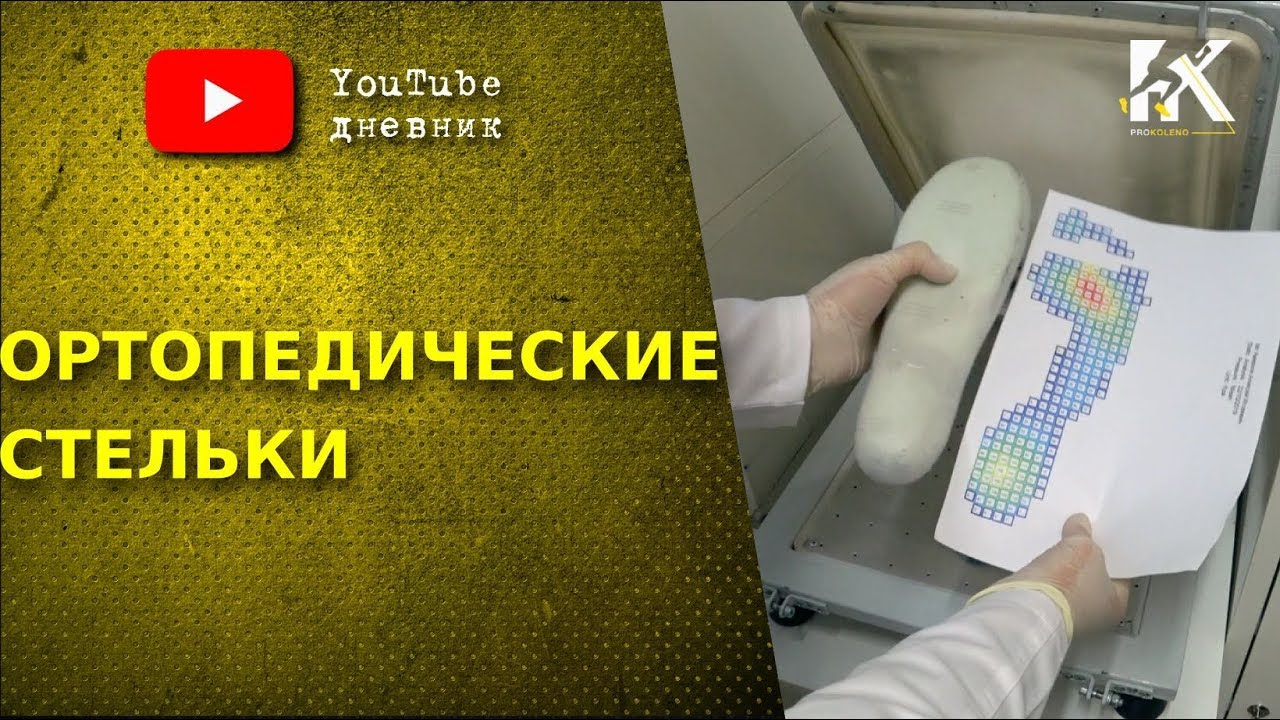 Ортопедические стельки. Плоскостопие. Проблемы с коленом. - YouTube