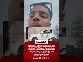 شاب يستغيث سرقوا الموتوسيكل مصدر رزقي الوحيد
