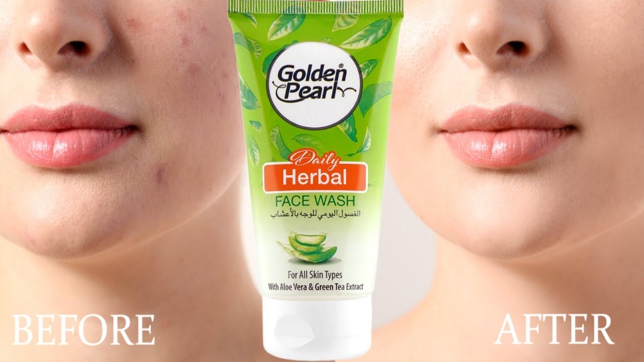 Best face wash for acne & pimples Golden pearl daily herbal Oil