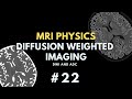Diffusion weighted imaging dwi and apparent diffusion coefficient adc  mri physics course 22