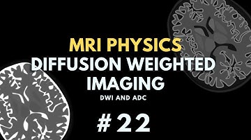 Diffusion Weighted Imaging (DWI) and Apparent Diffusion Coefficient (ADC) | MRI Physics Course #22