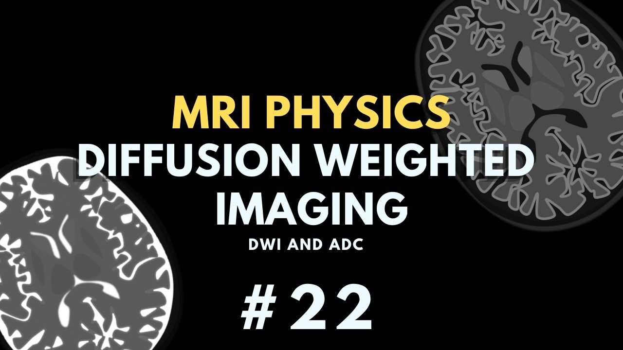 Diffusion Weighted Imaging DWI And Apparent Diffusion Coefficient diffusion-weighted-imaging-dwi-and-apparent-diffusion-coefficient