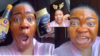 FAST CURE FOR sunburn / face rash / face discoloration / simple home remedy / facial routine 101