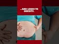 Junk food gives you momentary pleasure… but leaves behind OBESITY!