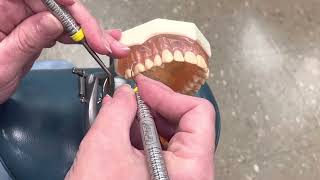Extra oral fulcrum maxillary posterior explorer - SIU dental hygiene 220