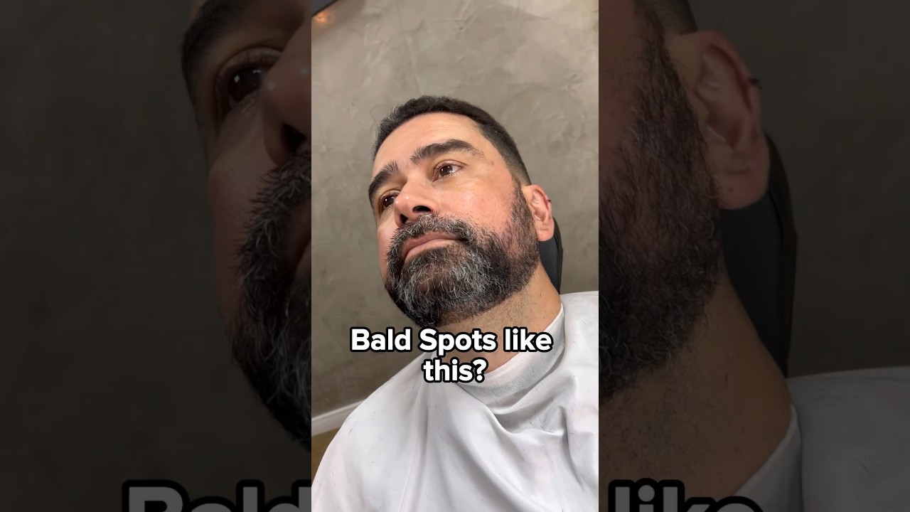 How to get rid of bald stops on your beard? 