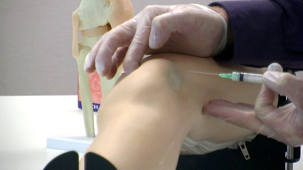 Infiltration du genou - tutoriel sur mannequin