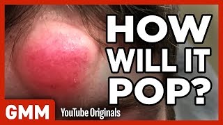 How Will This Pimple Pop? (GAME) ft. Dr. Pimple Popper screenshot 4