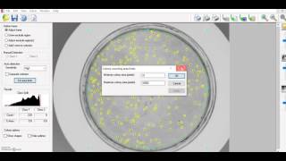 Colony Counting software in GeneSys from Syngene