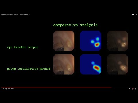 Colon Quality Assessment for Colon Cancer